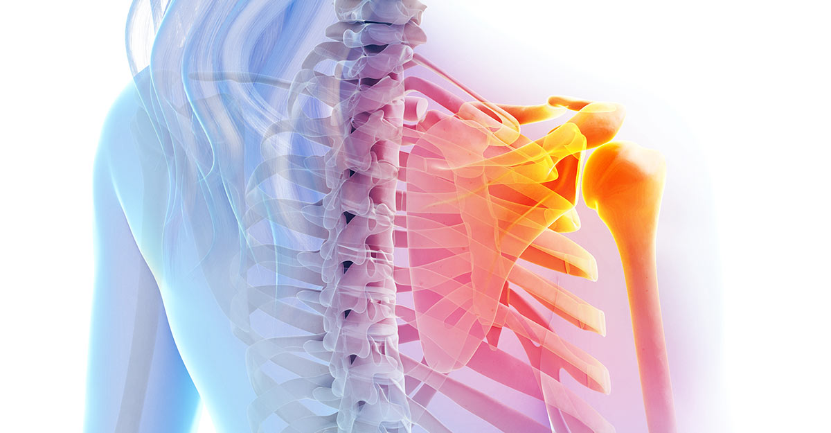 Yakima shoulder pain treatment and recovery